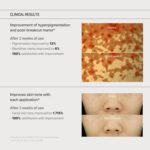 SOME BY MI Yuja Niacin Anti Blemish Cream - 60ml - Image 4