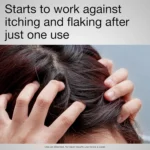 Neutrogena T/Gel Therapeutic Shampoo 250ml - Image 2