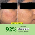 Dot and Key Cica + Niacinamide Calming Oil Free Moisturizer for Acne Prone Skin 15 ML - Image 2