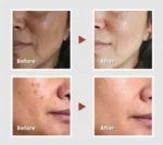 KSECRET Collagen Vita Secret Multi Balm 11g - Image 3