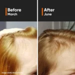 Minimalist Hair Growth Actives 18% Hair Serum 30ml - Image 4