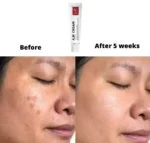 W.SKIN LAB AM Anti Melasma Cream 50ml - Image 2