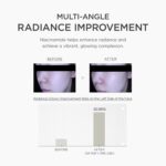 SKIN1004 Madagascar Centella Niacinamide 10 Boosting Shot