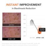 APRIL SKIN CARROTENE IPMP HYDROMELT CLEANSING BALM 90ml - Image 4